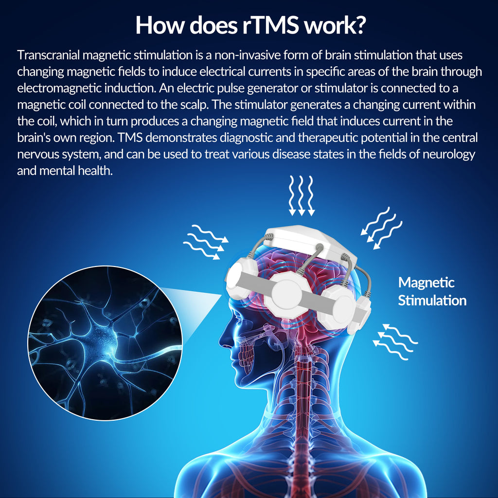 ZJKC TMS Treatment for Depression Parkinson's Deep Brain Memory Enhancement And Brain Stimulation Reduce Long Term Nerve Damage