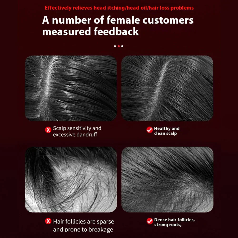 Electric Hair Regrowth Brush with Infrared Light