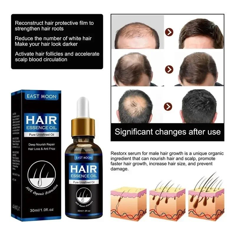 Hair Growth Oil Effective Rapid Repair Fast Baldness Hair Postpartum Hair Loss Follicles Hereditary Hair Loss Hair Care Solution.